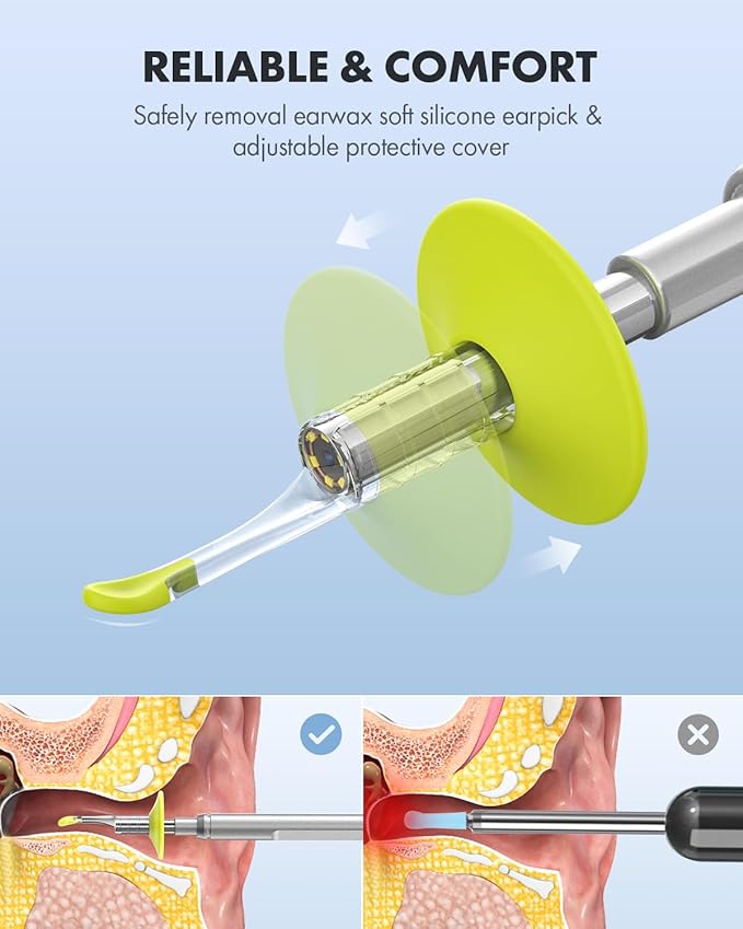 Anykit Digital Otoscope with Gyroscope, 4.5 Inches Screen, 3.9mm Ear Scope