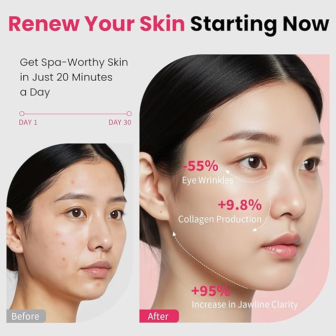Face Lift Device – 8 in 1 Skin Tightening and Lifting, LED Light Therapy