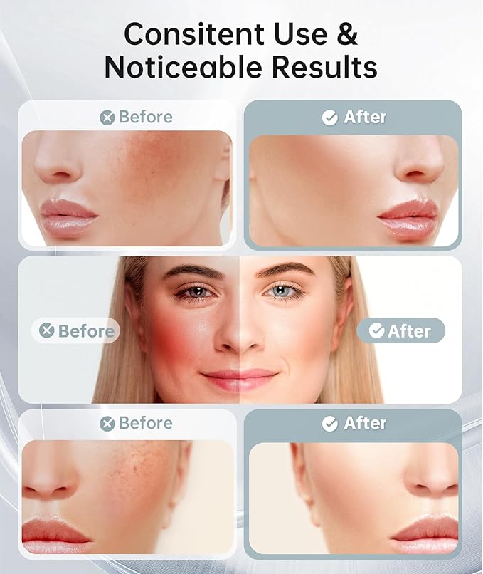 Dopsikn 7 Color Light Therapy Facial Massager