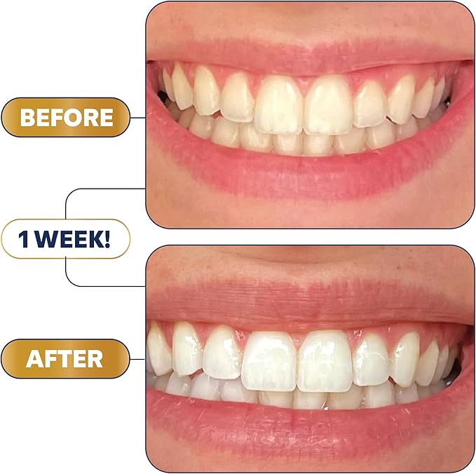 Lumineux Teeth Whitening Strips
