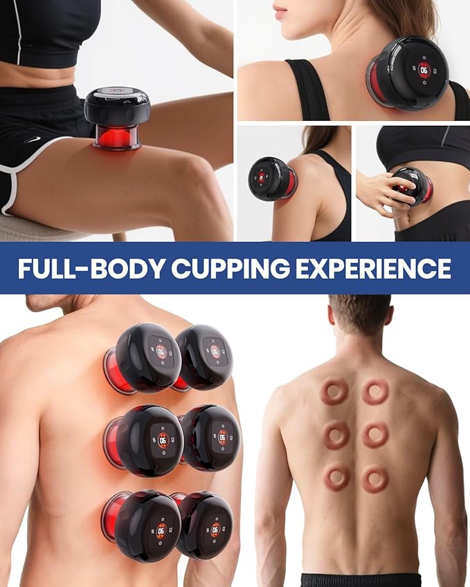 EURPMASK Choose the color of europe 5-in-1 Electric Cupping Kit
