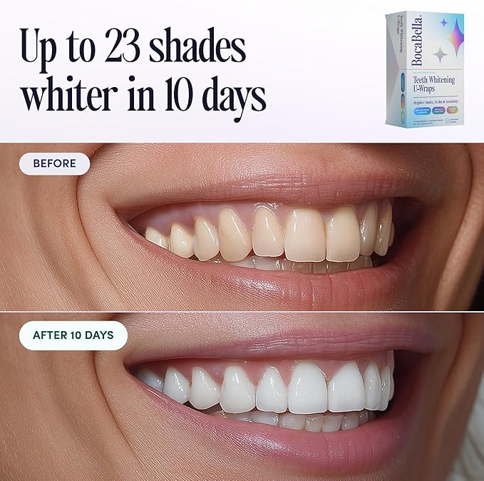 Boca Bella Teeth Whitening U-Wraps – 10 Treatments – 15% Hydrogen Peroxide